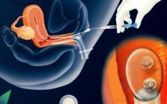 在国外生孩子要多少钱？费用因情况而异!