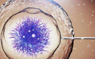 多囊卵巢综合征是什么原因导致的？怎么治疗？严不严重？